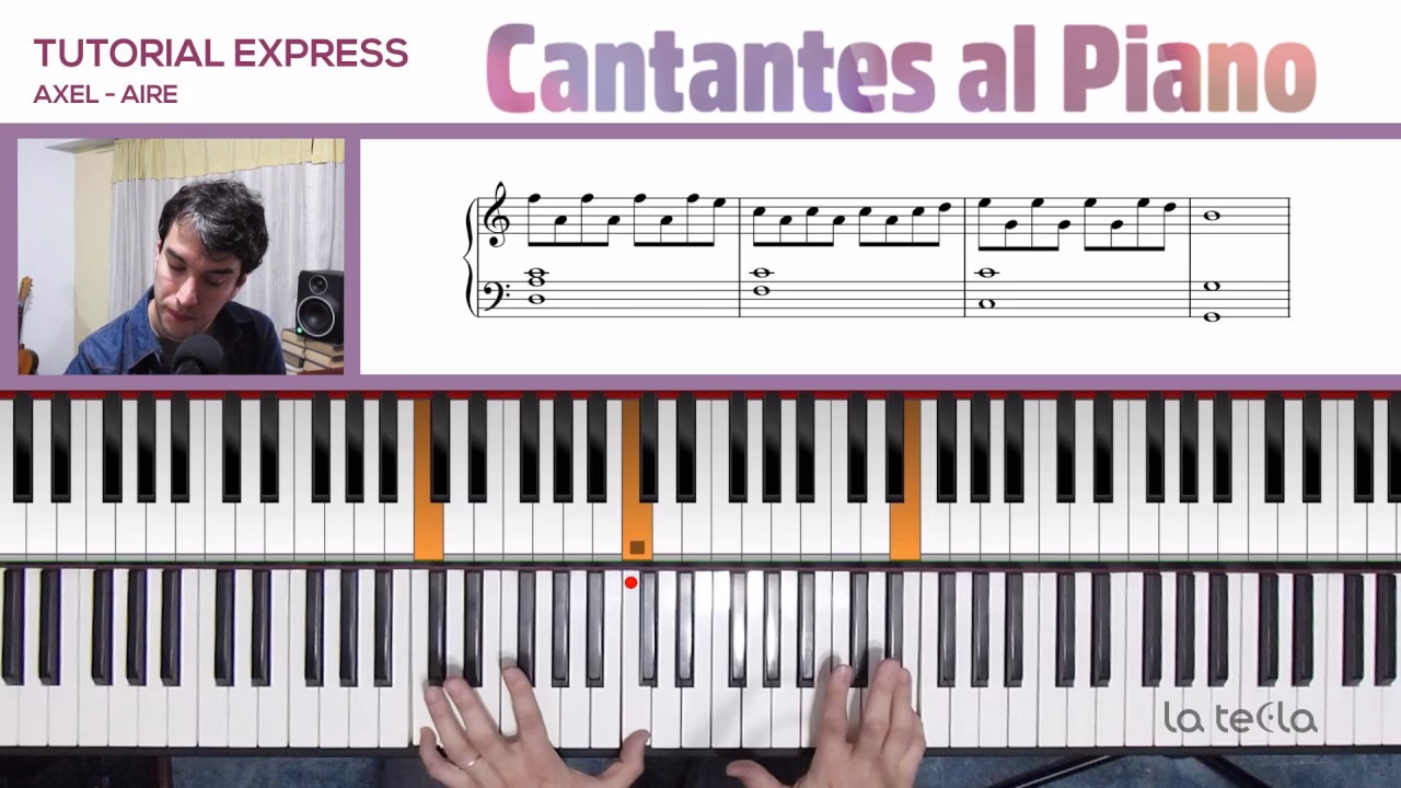 ¿Qué le pasó a Axel Rose?